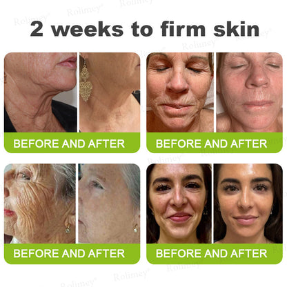 🔥 𝐅𝐥𝐚𝐬𝐡 𝐒𝐚𝐥𝐞: 𝟓𝟎% 𝐎𝐅𝐅 – 𝐑𝐨𝐥𝐢𝐦𝐞𝐲® 🧑‍⚕️ 𝐁𝐨𝐭𝐨𝐱-𝐋𝐢𝐤𝐞 𝐏𝐞𝐩𝐭𝐢𝐝𝐞𝐬 + 𝐕𝐢𝐭𝐚-𝐀 𝐑𝐞𝐭𝐢𝐧𝐨𝐥 𝐒𝐡𝐨𝐭 – 𝐖𝐫𝐢𝐧𝐤𝐥𝐞-𝐋𝐢𝐟𝐭 𝐓𝐢𝐠𝐡𝐭𝐞𝐧𝐢𝐧𝐠 𝐂𝐫𝐞𝐚𝐦