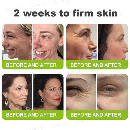 🔥 𝐅𝐥𝐚𝐬𝐡 𝐒𝐚𝐥𝐞: 𝟓𝟎% 𝐎𝐅𝐅 – 𝐑𝐨𝐥𝐢𝐦𝐞𝐲® 🧑‍⚕️ 𝐁𝐨𝐭𝐨𝐱-𝐋𝐢𝐤𝐞 𝐏𝐞𝐩𝐭𝐢𝐝𝐞𝐬 + 𝐕𝐢𝐭𝐚-𝐀 𝐑𝐞𝐭𝐢𝐧𝐨𝐥 𝐒𝐡𝐨𝐭 – 𝐖𝐫𝐢𝐧𝐤𝐥𝐞-𝐋𝐢𝐟𝐭 𝐓𝐢𝐠𝐡𝐭𝐞𝐧𝐢𝐧𝐠 𝐂𝐫𝐞𝐚𝐦
