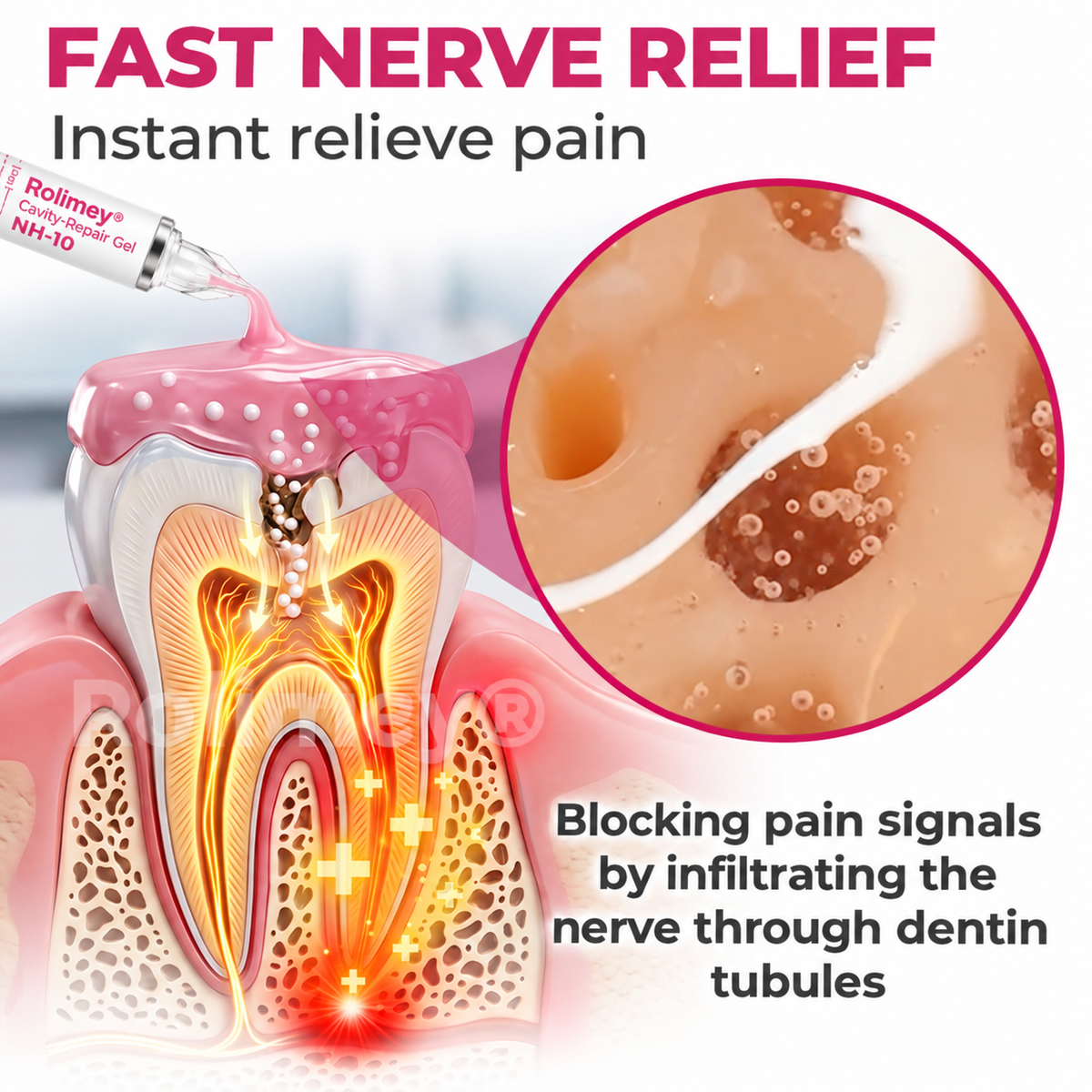 🧑‍⚕️Rolimey® DenPerm Cavity-Repair Natural Enamel Filling Gel