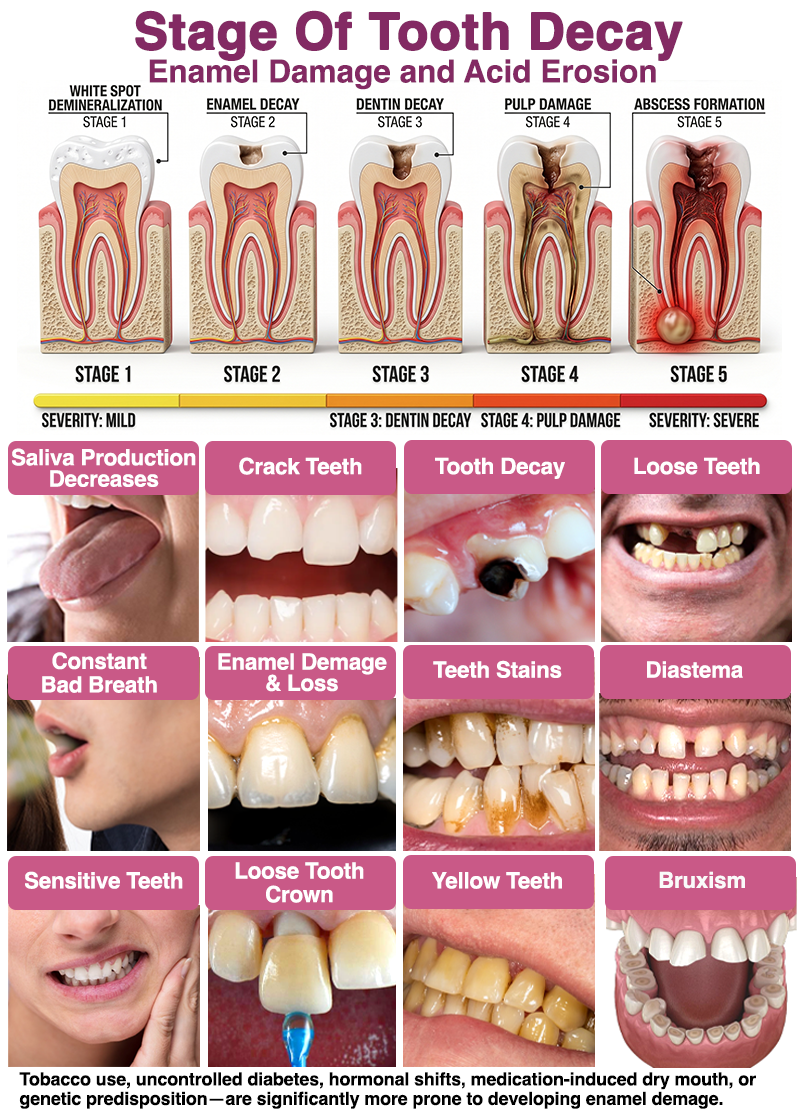 🧑‍⚕️Rolimey® DenPerm Cavity-Repair Natural Enamel Filling Gel