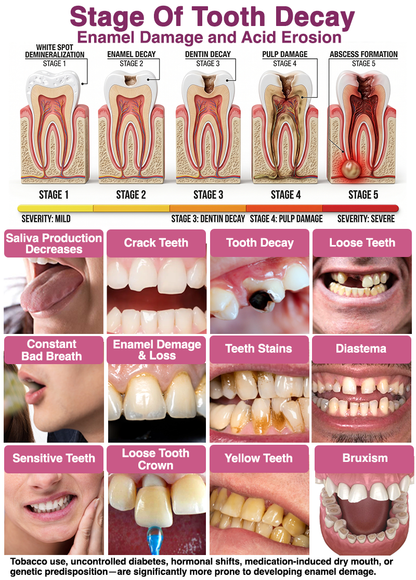 🧑‍⚕️Rolimey® DenPerm Cavity-Repair Natural Enamel Filling Gel