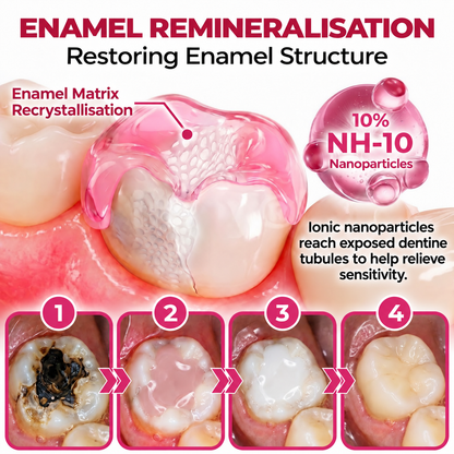🧑‍⚕️Rolimey® DenPerm Cavity-Repair Natural Enamel Filling Gel