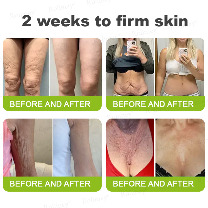 🔥 𝐅𝐥𝐚𝐬𝐡 𝐒𝐚𝐥𝐞: 𝟓𝟎% 𝐎𝐅𝐅 – 𝐑𝐨𝐥𝐢𝐦𝐞𝐲® 🧑‍⚕️ 𝐁𝐨𝐭𝐨𝐱-𝐋𝐢𝐤𝐞 𝐏𝐞𝐩𝐭𝐢𝐝𝐞𝐬 + 𝐕𝐢𝐭𝐚-𝐀 𝐑𝐞𝐭𝐢𝐧𝐨𝐥 𝐒𝐡𝐨𝐭 – 𝐖𝐫𝐢𝐧𝐤𝐥𝐞-𝐋𝐢𝐟𝐭 𝐓𝐢𝐠𝐡𝐭𝐞𝐧𝐢𝐧𝐠 𝐂𝐫𝐞𝐚𝐦
