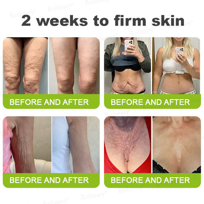 🔥 𝐅𝐥𝐚𝐬𝐡 𝐒𝐚𝐥𝐞: 𝟓𝟎% 𝐎𝐅𝐅 – 𝐑𝐨𝐥𝐢𝐦𝐞𝐲® 🧑‍⚕️ 𝐁𝐨𝐭𝐨𝐱-𝐋𝐢𝐤𝐞 𝐏𝐞𝐩𝐭𝐢𝐝𝐞𝐬 + 𝐕𝐢𝐭𝐚-𝐀 𝐑𝐞𝐭𝐢𝐧𝐨𝐥 𝐒𝐡𝐨𝐭 – 𝐖𝐫𝐢𝐧𝐤𝐥𝐞-𝐋𝐢𝐟𝐭 𝐓𝐢𝐠𝐡𝐭𝐞𝐧𝐢𝐧𝐠 𝐂𝐫𝐞𝐚𝐦