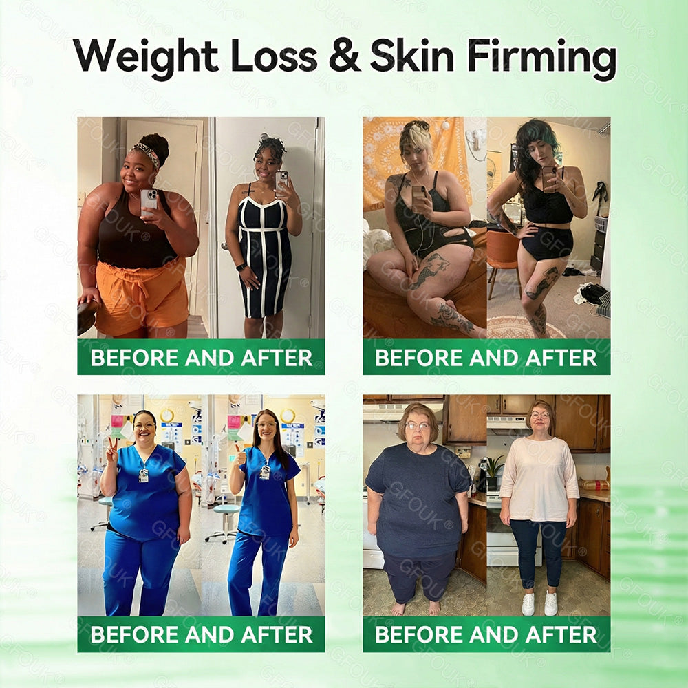 🇦🇺 🧑‍⚕️𝑶𝒇𝒇𝒊𝒄𝒊𝒂𝒍 𝑺𝒕𝒐𝒓𝒆  |GFOUK®✨ 𝑴𝒐𝒓𝒊𝒏𝒈𝗮 · 𝗕𝗲𝗿𝗯𝗲𝗿𝙞𝙣𝙚 × 𝙉𝘼𝐃+ 𝟏𝟎-𝐢𝐧-𝟏 𝗔𝗱𝘃𝗮𝗻𝗰𝙚𝙙 𝙉𝙖𝙣𝙤 𝙈𝙞𝙘𝙧𝙤𝙣𝙚𝙚𝐝𝐥𝐞 𝐏𝐚𝐭𝙘𝙝🇺🇸(𝐉𝐮𝐬𝐭 𝐨𝐧𝐜𝐞 𝐚 𝐝𝐚𝐲, 𝐯𝐢𝐬𝐢𝐛𝐥𝐞 𝐜𝐡𝐚𝐧𝐠𝐞𝐬 𝐢𝐧 𝟕 𝐝𝐚𝐲𝐬） ✅ 𝐅𝐨𝐫 𝐨𝐛𝐞𝐬𝐢𝐭𝐲, 🅛🅞🅞🅢🅔 🅢🅚🅘🅝,𝐝𝐢𝐚𝐛𝐞𝐭𝐞𝐬, 𝐬𝐥𝐞𝐞𝐩 𝐚𝐩𝐧𝐞𝐚, 𝐣𝐨𝐢𝐧𝐭 𝐢𝐬𝐬𝐮𝐞𝐬, 𝐚𝐧𝐝 𝐦𝐨𝐫𝐞