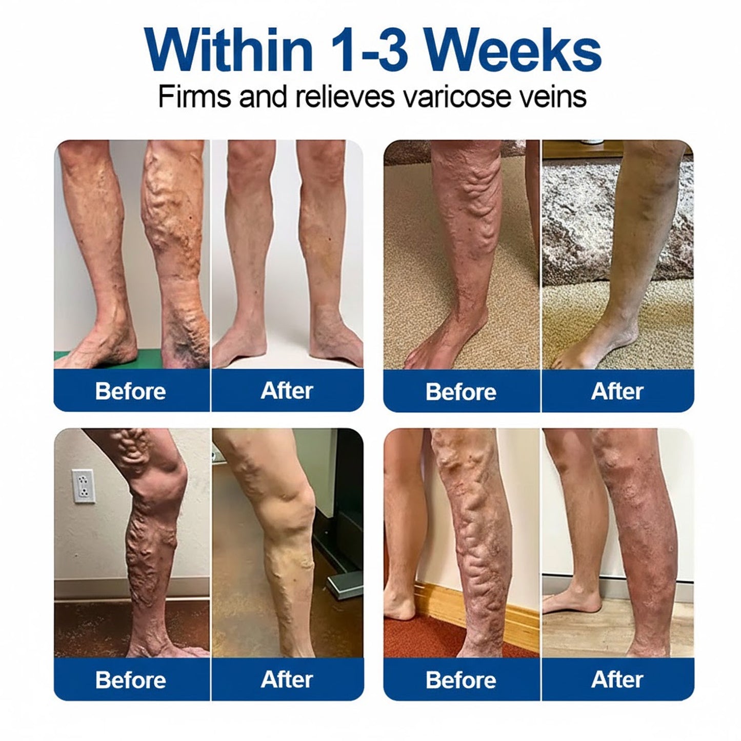 🧑‍⚕️GFOUK® VeinTarget Microneedle Patch⚡Instant Relief, Long-Term Results